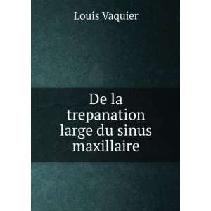  De la trepanation large du sinus maxillaire Louis Vaquier 