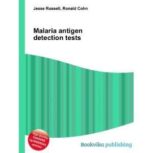  Malaria antigen detection tests Ronald Cohn Jesse Russell Books