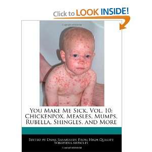  Sick Shit, Vol. 10 Chickenpox, Measles, Mumps, Rubella 